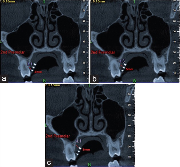 Figure 4a