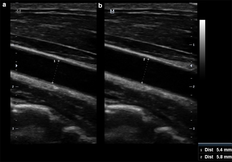 Fig. 3