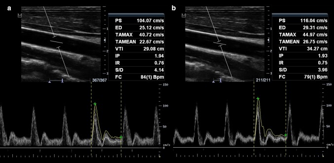 Fig. 2