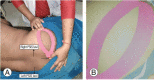 Fig. 7.