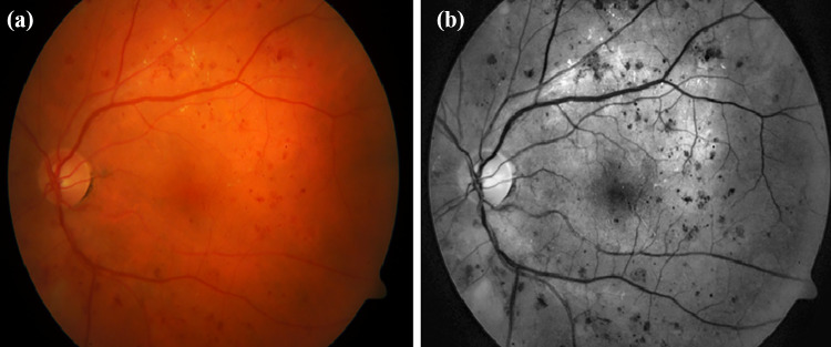 Fig. 3