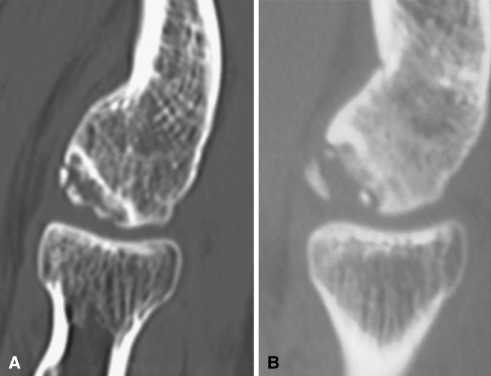 Fig. 5A–B