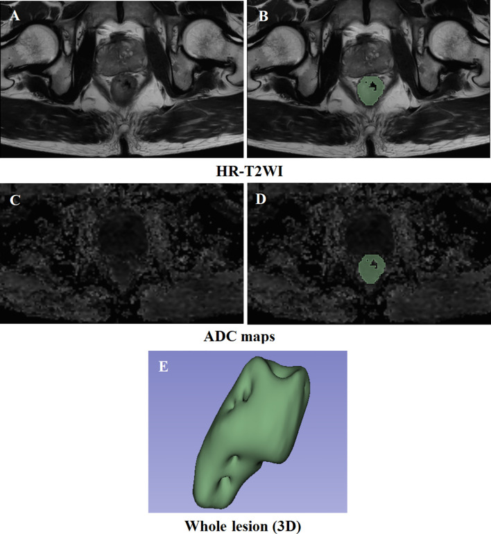 Figure 2