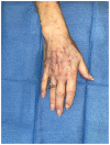Fig 2