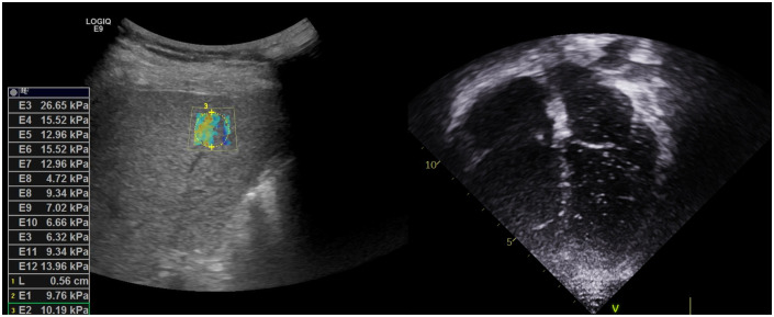 Figure 1