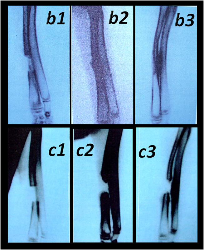 FIGURE 13