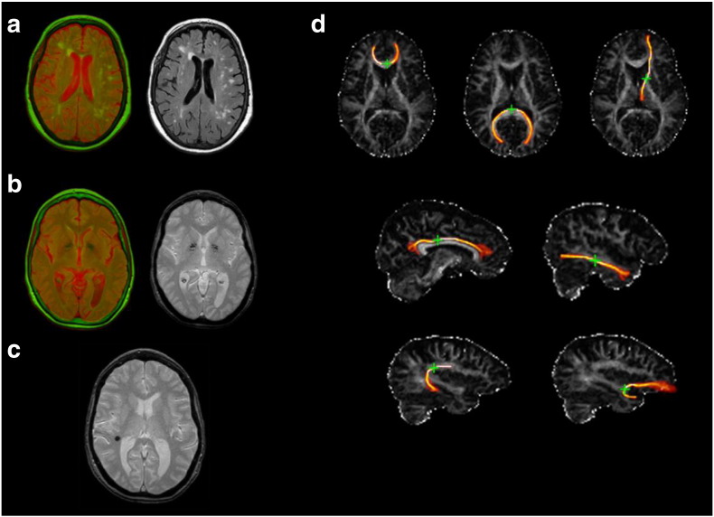 Fig. 1