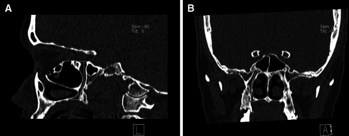 Fig. 1