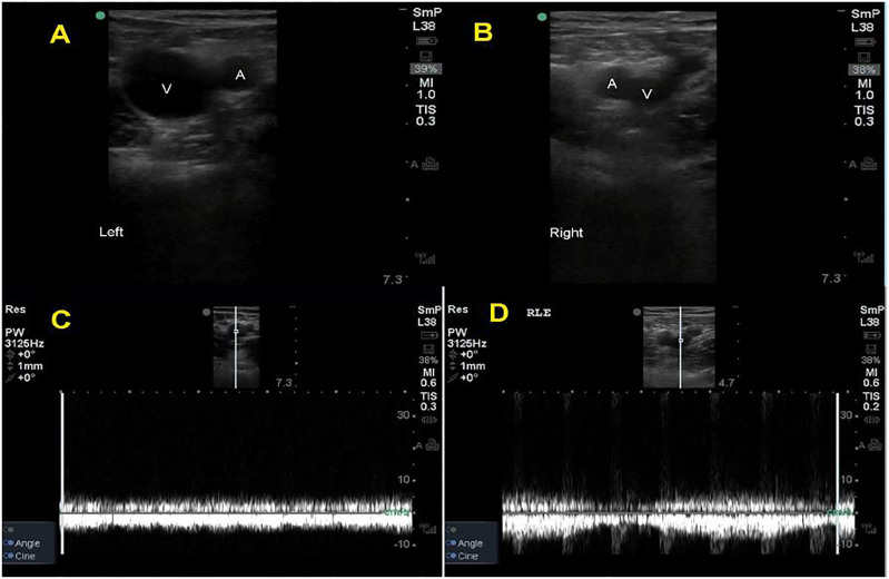 Image 1A, B