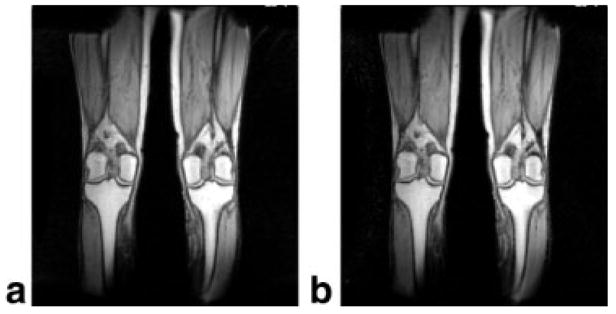 FIG. 10