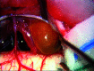 FIG 2.