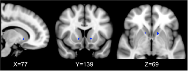 Fig. 11