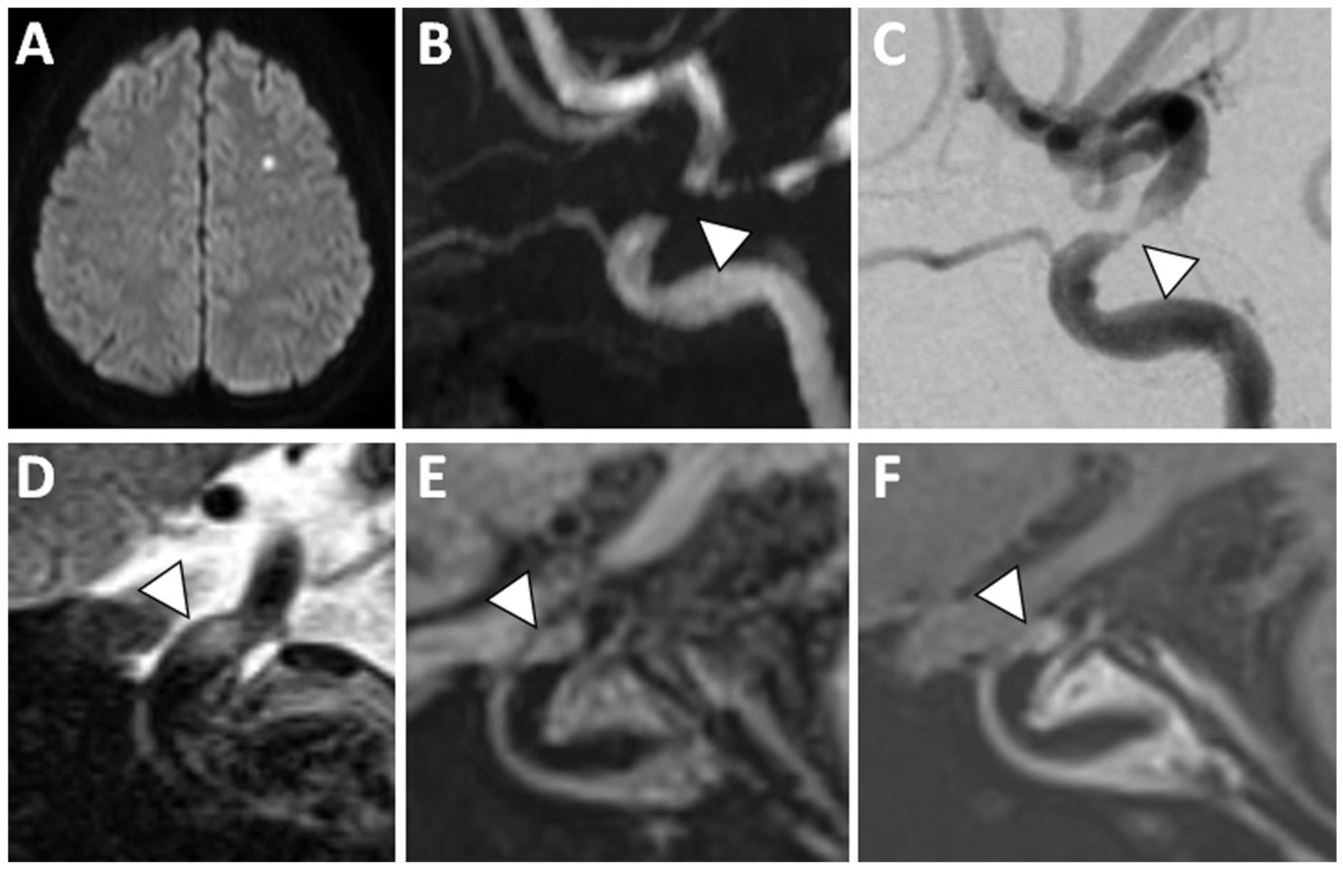 Figure 4: