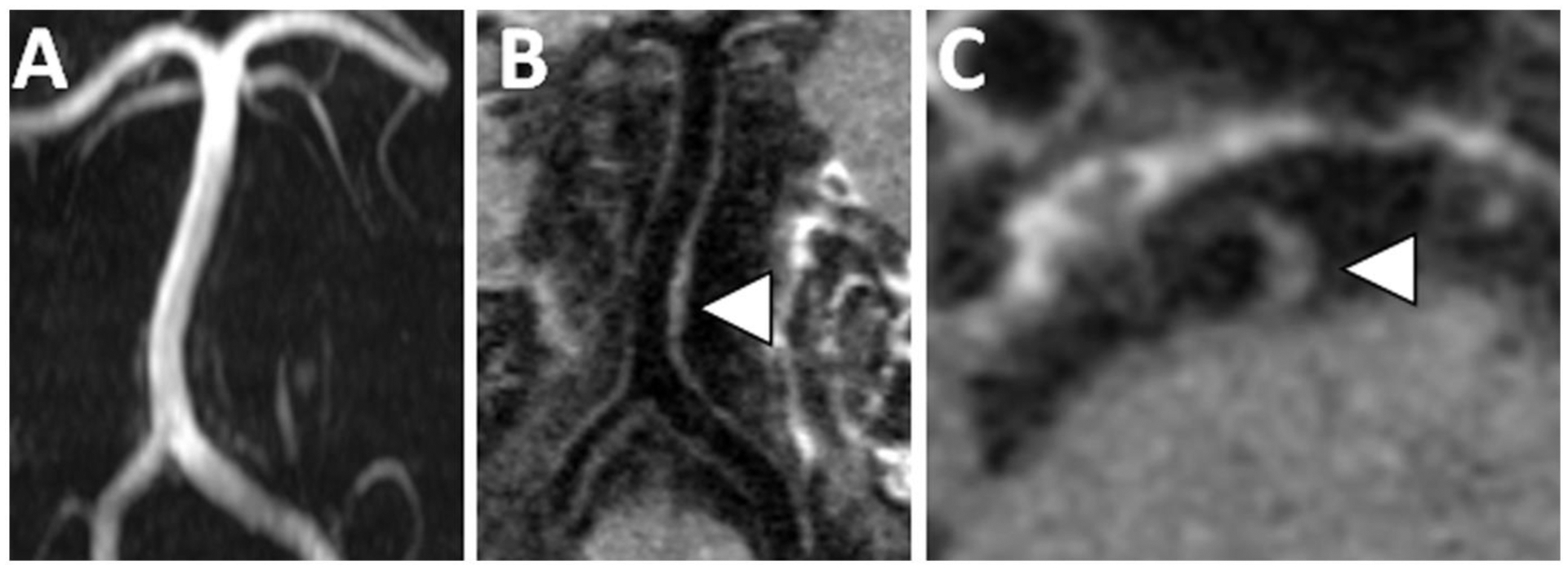 Figure 3: