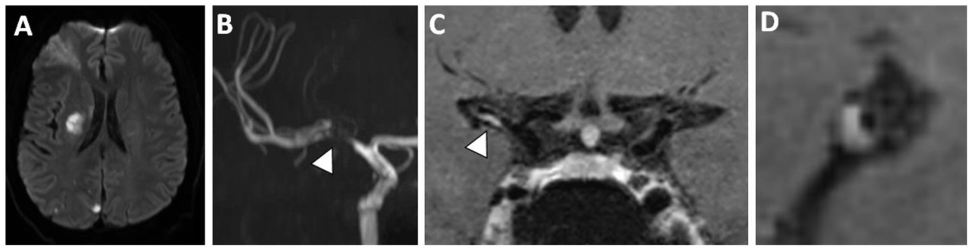 Figure 2: