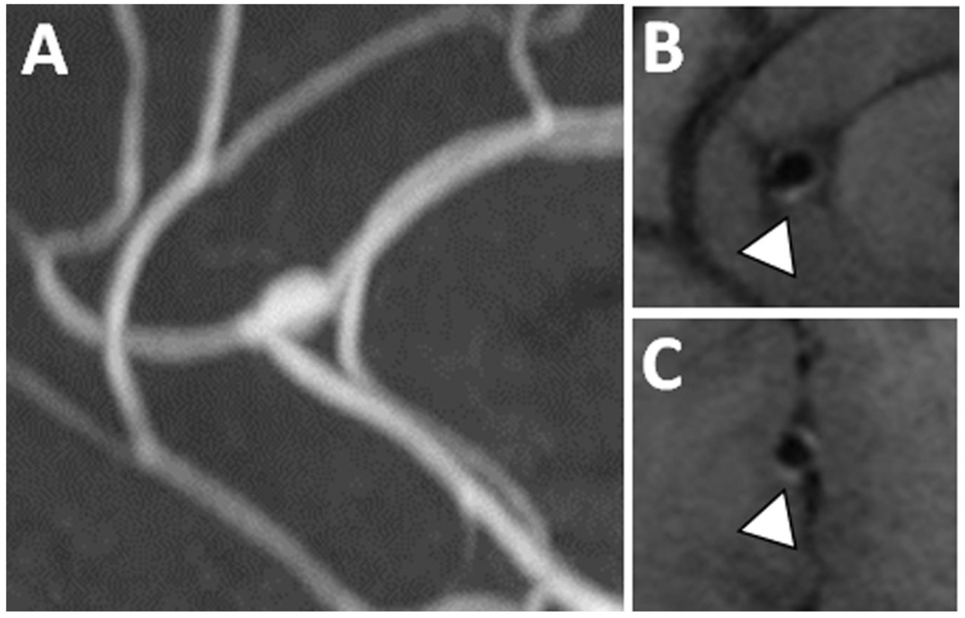 Figure 11: