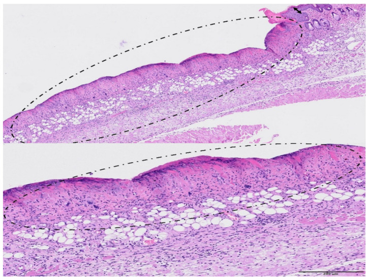 Figure 11