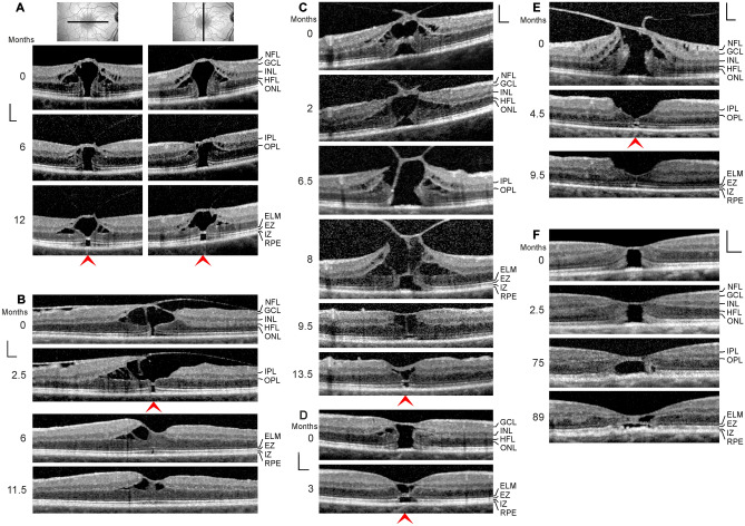 Fig. 4