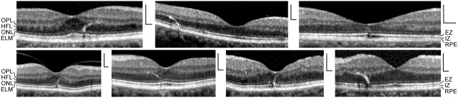 Fig. 2