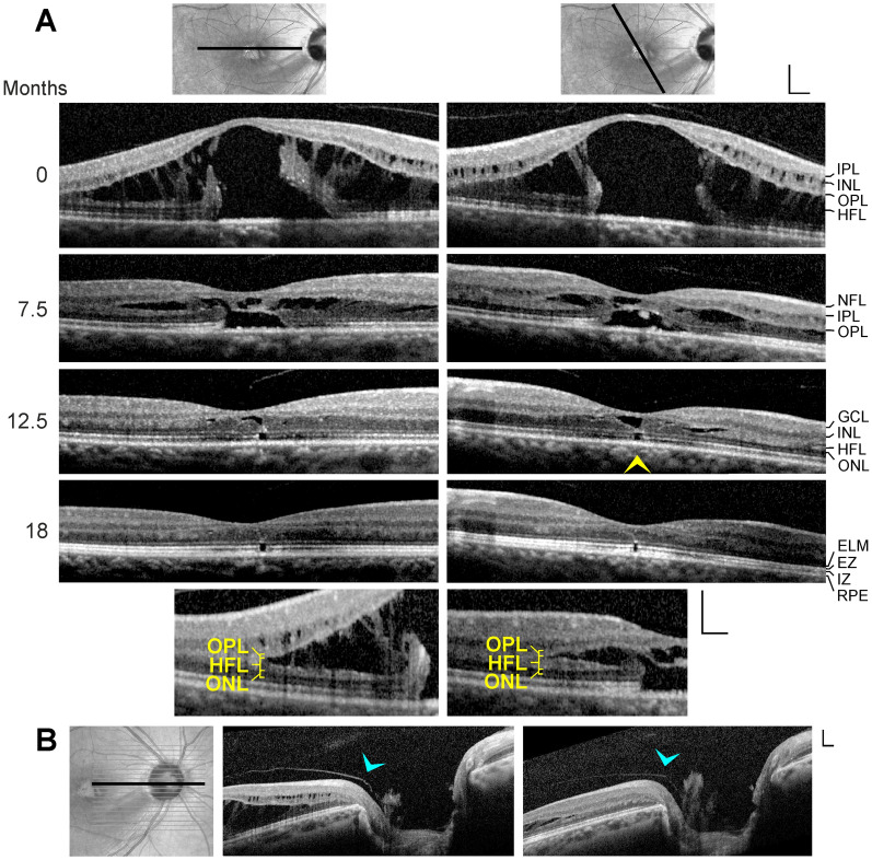 Fig. 5