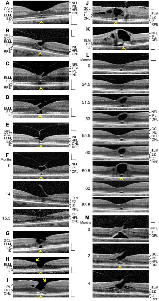 Fig. 3