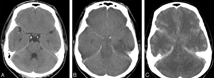 Fig 3.