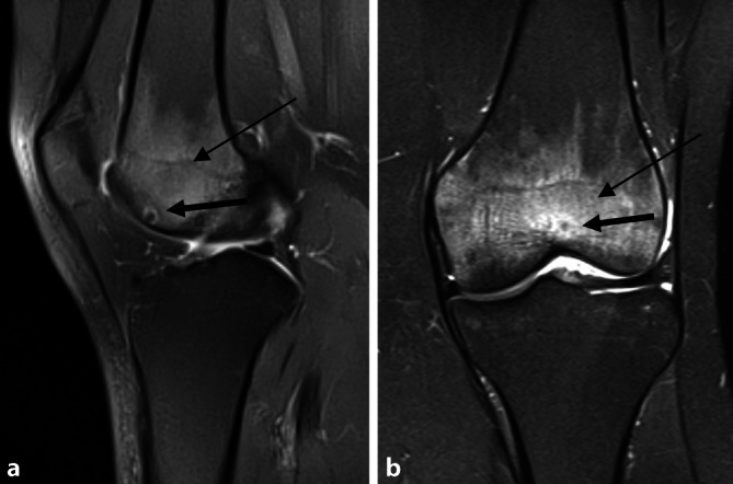 graphic file with name 132_2022_4218_Fig1_HTML.jpg