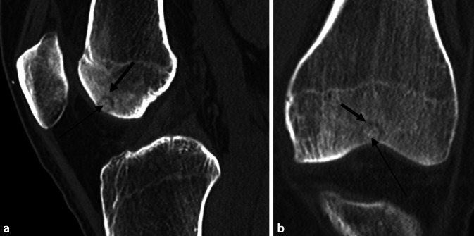 graphic file with name 132_2022_4218_Fig2_HTML.jpg