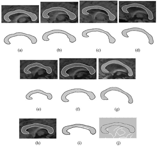 Fig. 11