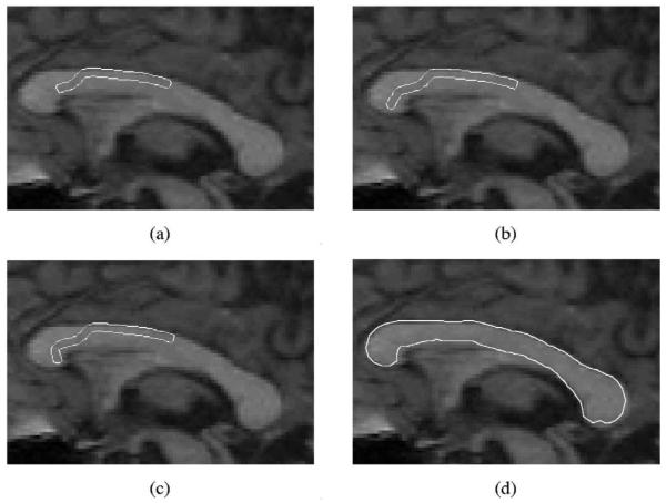 Fig. 13