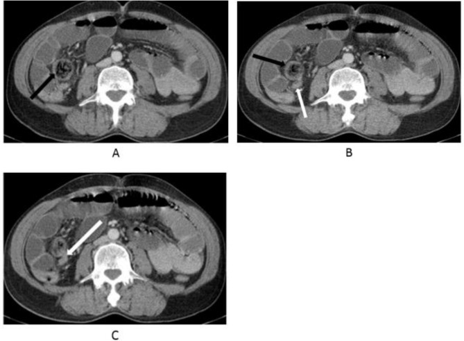 Fig. 1: