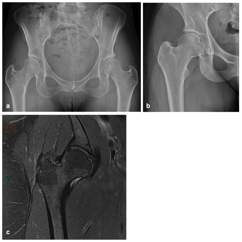 Figure 13 a–c