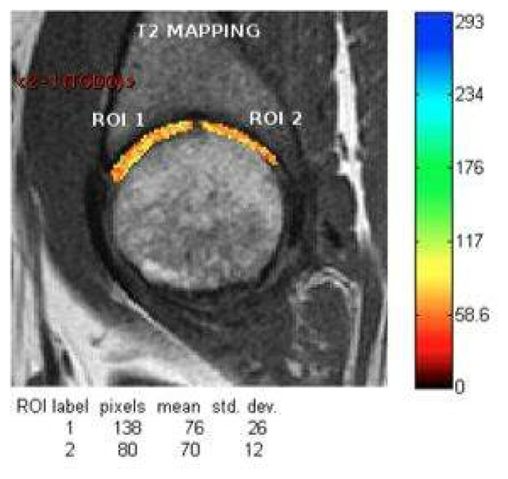 Figure 28