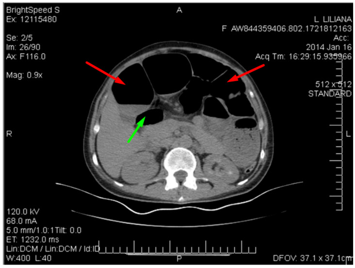 Figure 4