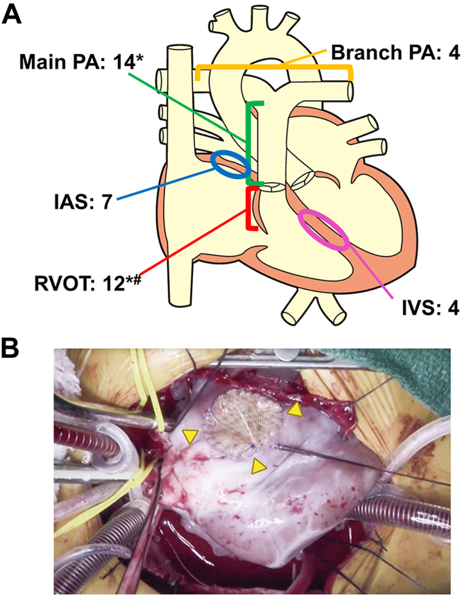 Figure 3