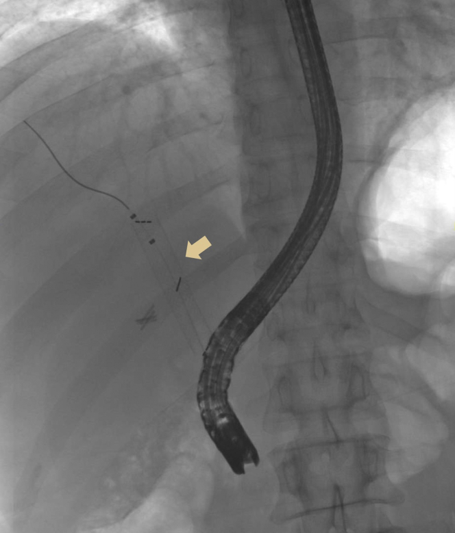 Figure 1