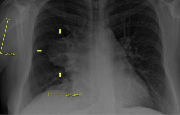 Figure 1