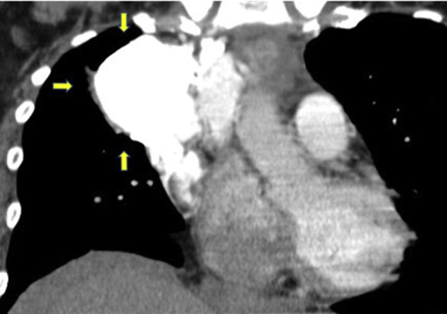 Figure 4