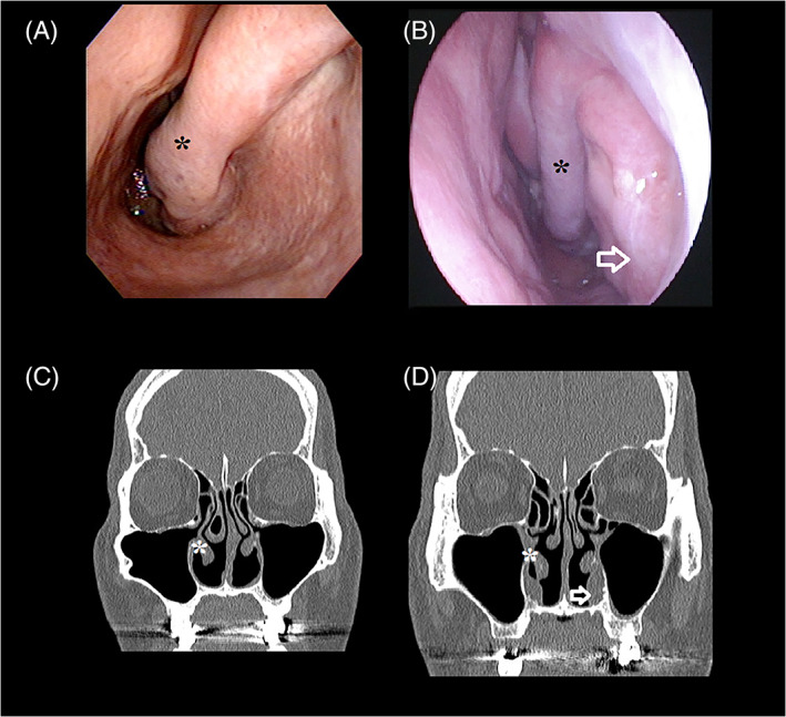 FIGURE 1