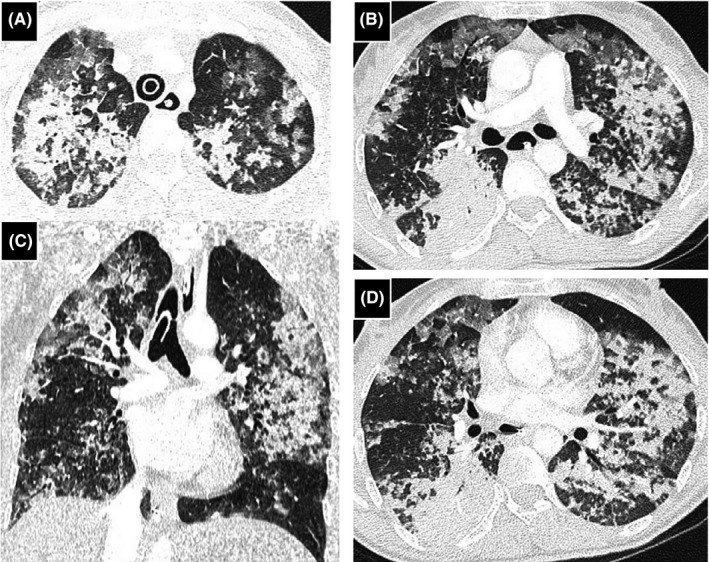 FIGURE 1