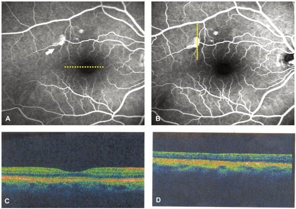 Fig. 4