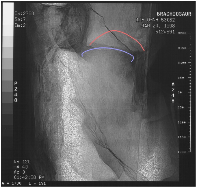 Figure 13