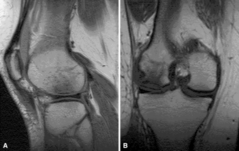 Fig. 3A–B