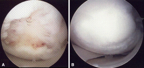 Fig. 2A–B