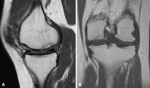 Fig. 4A–B