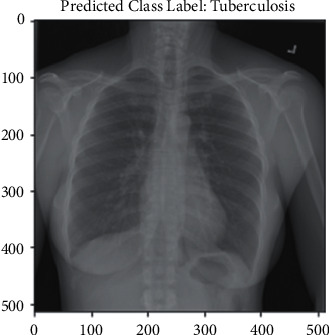 Figure 11