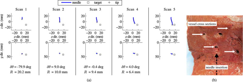 Fig. 12