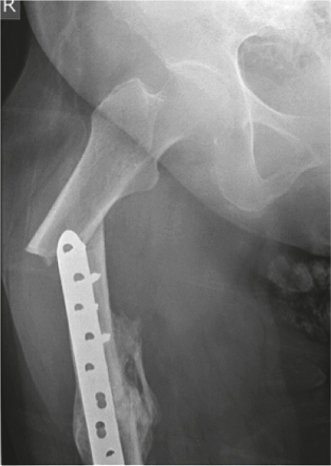 Figure 2.