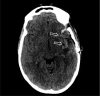 Fig1