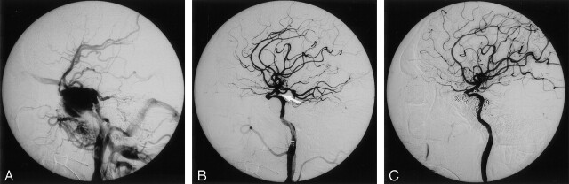 Fig 2.